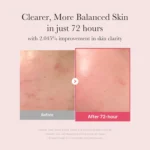 Medicube TXA Niacinamide Serum - Image 2