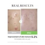 Medicube Exosome Cica Cream - Image 4