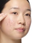 The Ordinary Aloe 2% + NAG 2% Solution - Image 2